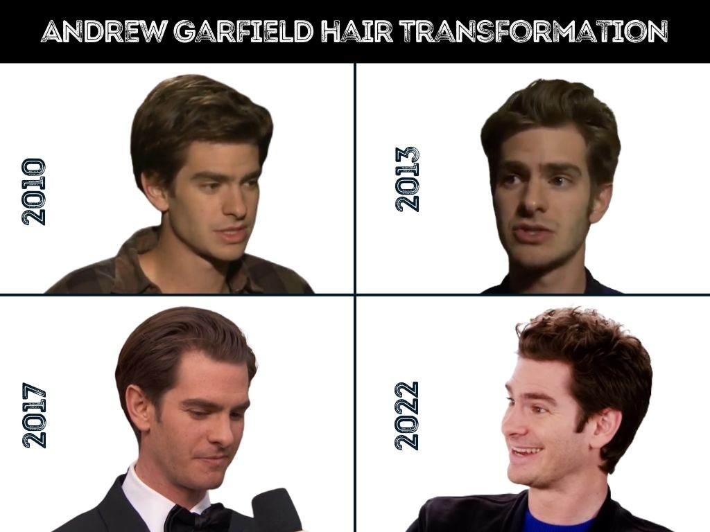 Andrew Garfield Hair Transplant Rumors: Whats True and Whats Not?